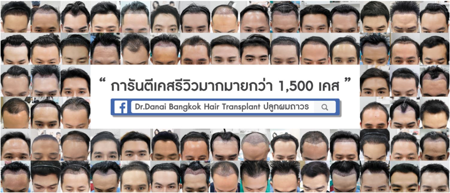 ภาพรวมเคส